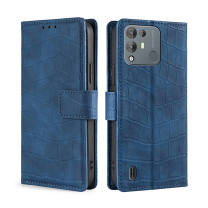 For Blackview A55 Pro Skin Feel Crocodile Magnetic Clasp Leather Phone Case(Blue) - More Brand by buy2fix | Online Shopping UK | buy2fix