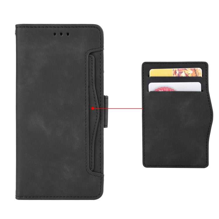 For Sony Xperia 10 VI 2024 Skin Feel Calf Texture Card Slots Leather Phone Case(Black) - Sony Cases by buy2fix | Online Shopping UK | buy2fix